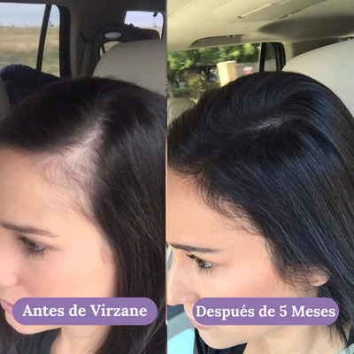 Crecimiento Capilar Avanzado para Mujeres de Virzane