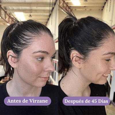 Crecimiento Capilar Avanzado para Mujeres de Virzane