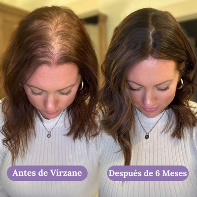 Crecimiento Capilar Avanzado para Mujeres de Virzane